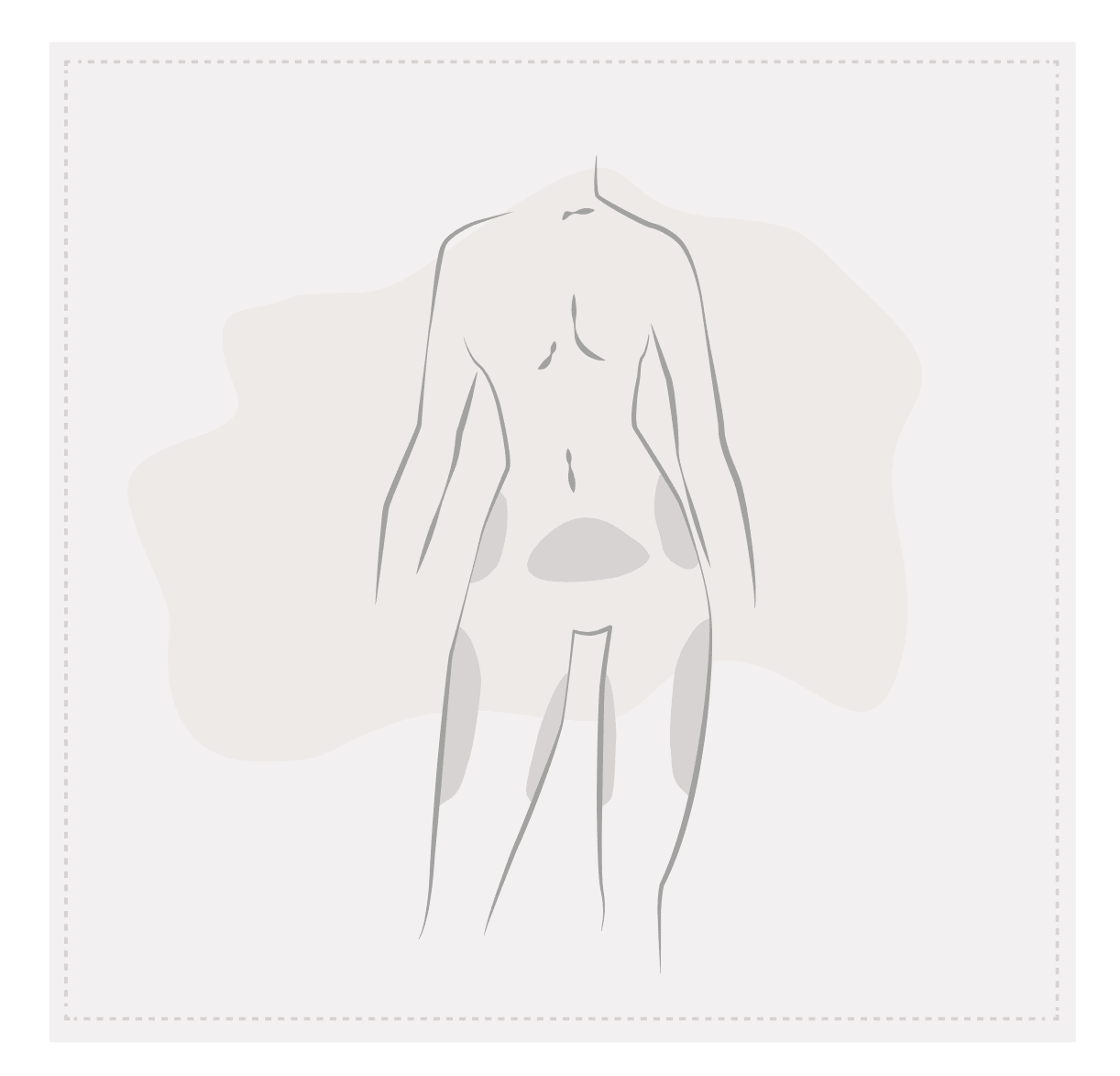 Körpersilhouette mit markierten Fett-Spenderzonen: Bauch, Hüften, Oberschenkel