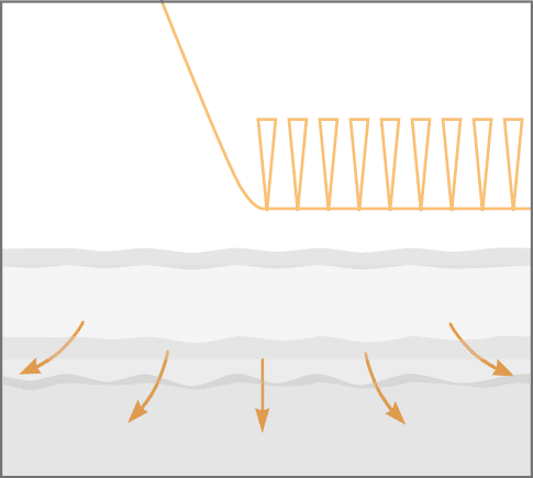 Schritt 4: Elastin- und Kollagenbildung wird stimuliert