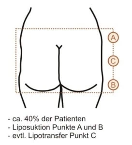 Quadratische Po-Form mit Behandlungspunkten A, B und C