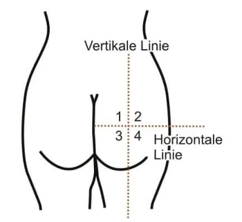 Quadranten-System zur Po-Analyse mit vertikaler und horizontaler Linie